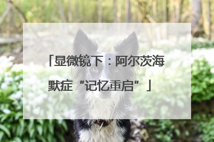 显微镜下：阿尔茨海默症“记忆重启”